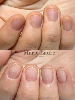 マリーロール 淀屋橋本店(Marie Laure)/自爪育成/深爪矯正/ネイルケア