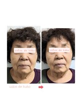 サロン ド 花歩 松山本店/シワたるみエイジングケアに◎