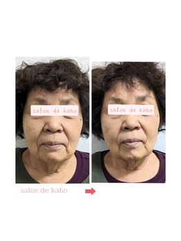 サロン ド 花歩 松山本店/シワたるみエイジングケアに◎