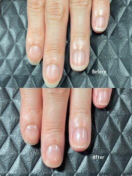 クーラ アンド ベリッシモ(Cura&Bellissimo)/3ヶ月集中コース