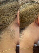 エース(ACE.)/うなじ、放置してないですか？