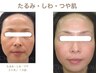★たるみ・しわ・つや肌ケア★フェイシャル60分＋排出リンパマッサージ90分