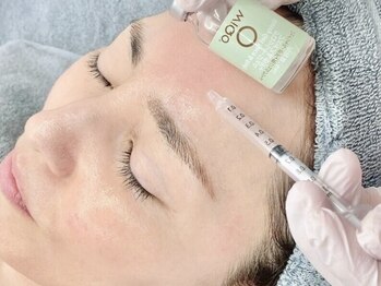 ビズビズ 梅田店(bisebise)の写真/都度払いOK！ちゅるん透明艶肌★staffが毎月する施術WiQoマッサージピール+光フォト+ハイドラ毛穴洗浄