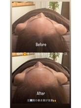 ドゥース 自由が丘(Douce)/施術ビフォーアフター