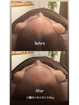 ドゥース 自由が丘(Douce)/施術ビフォーアフター