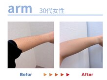 キングスサロン 熊本/