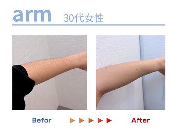 キングスサロン 熊本/