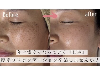 シャンティ(Shanti)の写真