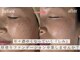 シャンティ(Shanti)の写真