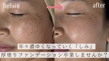 シャンティ(Shanti)