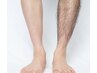 【男性脱毛】ハイスピード光両膝下スネ脱毛☆　