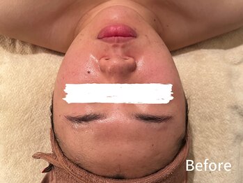 ダイヤモンド リーエンダ(Diamond leende)/クレイハーブピーリング