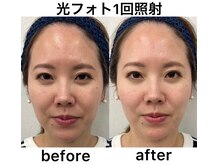 クリア アイラッシーズ アンド ネイルサロン シャイン(CLEAR & SHINE)/