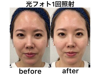 クリア アイラッシーズ アンド ネイルサロン シャイン(CLEAR & SHINE)/