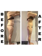 ヘルバ(HERBA)/痩身