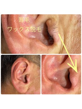 エピファニー(Epi phany Total Beauty Salon)/耳毛脱毛Wax