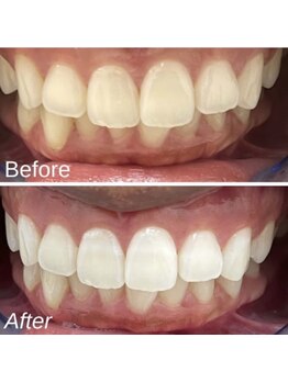 ホヌオラ(Honu Ola)/☆ホワイトニング初回限定☆