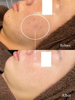 ベベクロスディディア 野々市市役所前店(Bebe×DiDiA)/お肌変化