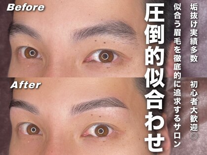 メンズ脱毛サロン ボス(BOSS)の写真