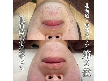 ファースト(1st)