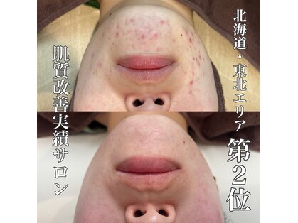 ファースト(1st)の写真