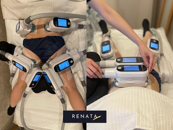 レナータ 大宮店(RENATA)の写真/【結果重視！】脂肪冷却 全身８カップ美しいカラダ作り★結婚式前のブライダルエステにも当店で絶大な人気!