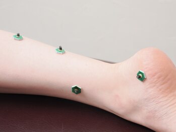 トラスト整骨院鍼灸院/鍼灸で身体の内側からアプローチ