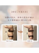 タージュ(Tage)/【健康・痩身目的リピーター様】