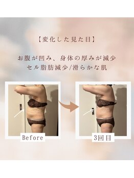 タージュ(Tage)/【健康・痩身目的リピーター様】