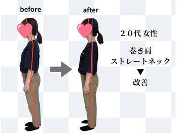 天白はら整体院アクト/巻き肩/骨盤矯正/肋骨引き締め