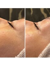 ビュウナ 銀座(BEAUNA)/アルティメットパルス