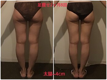 ビープロデュース 亀有店(BPRODUCE)/Before &after