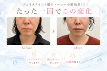 ヨサパーク ベル 福工大前店(YOSA PARK Belle)
