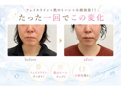ヨサパーク ベル 福工大前店(YOSA PARK Belle)の写真