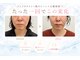 ヨサパーク ベル 福工大前店(YOSA PARK Belle)の写真