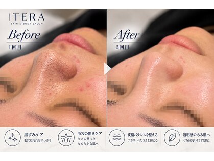 イテラ 名古屋栄店(ITERA)の写真