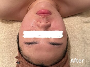 ダイヤモンド リーエンダ(Diamond leende)/クレイハーブピーリング