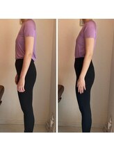 エスアップ 麻布十番店(THE S-UP)/施術前後写真