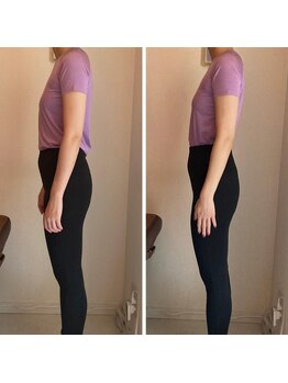 エスアップ 麻布十番店(THE S-UP)/施術前後写真