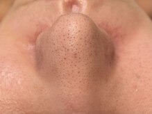 ウェクシー(WECXII)/