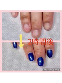 深爪矯正しながらカラー