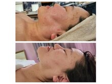 ミエリフル(Miel et Fleurs)の雰囲気（体重の変化はなし、頭の水分が抜けただけでこちらの結果。）