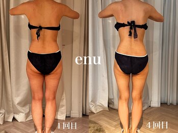 エヌ 白金台(enu)/ブライダルにもおすすめ