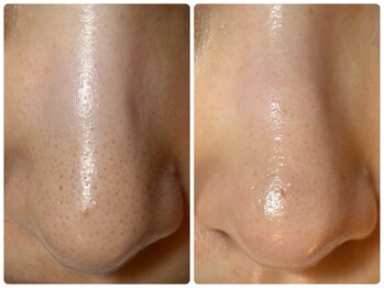 サイセイ(SAISEI)/