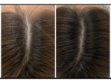 ルミア(LUMIA)の雰囲気（前髪が伸びない・毛量が減ったなどのお悩みに）