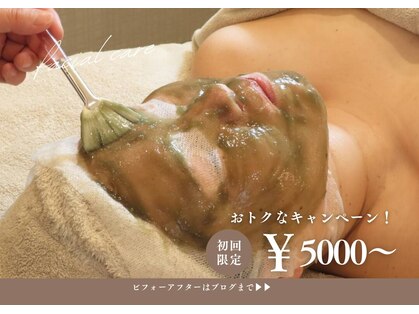 ミイエステ(miiest)の写真