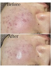 ブラックボックス(BLACK BOX)/20代女性のお客様