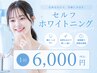【セルフホワイトニング】黄ばみ・着色・くすみに◎清潔感ある白い歯へ♪