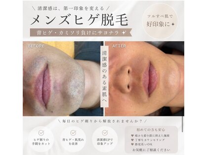 街ノビヨウダツモウの写真