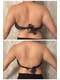 エノアシュエット(Enoachouette)の写真/寝ているだけの最新痩身で、運動や食事で落ちない脂肪を撃退!理想のラインを追求♪